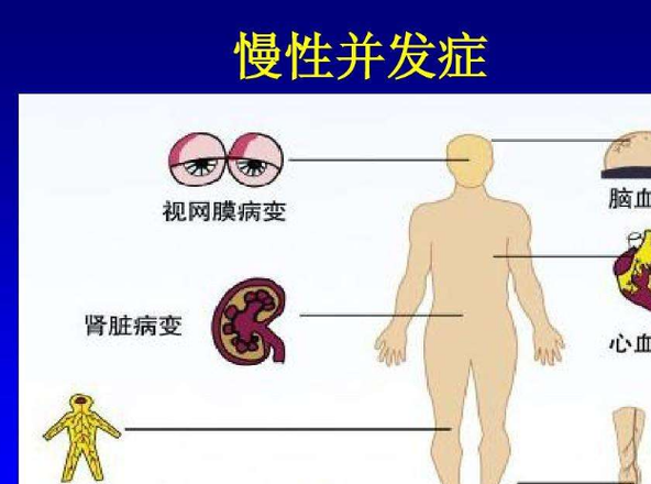 糖尿病肾病无声的肾脏危机