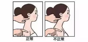 年轻人又开始吊脖子，现象背后的反思