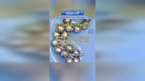 磁力珠与血尿的警示