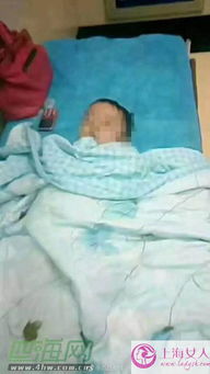 一岁幼童摔跤中风了