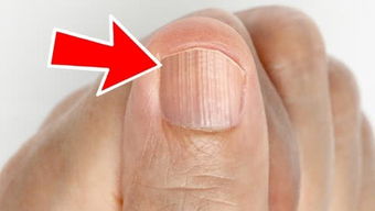 从中指没指甲谈人体的奥秘与文化象征