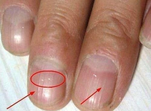 从中指没指甲谈人体的奥秘与文化象征