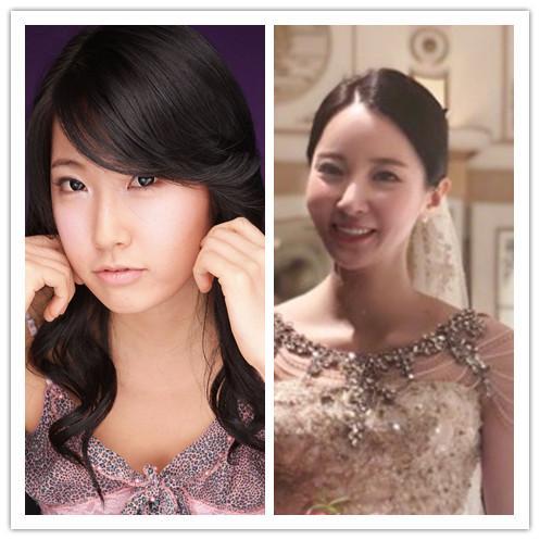 海清疑医美过度变样，审美标准与个人形象塑造的反思