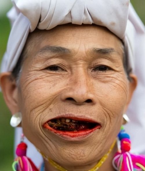 嚼槟榔20年变割脸人，一场无声的悲剧