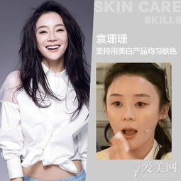 美丽背后的挑战，揭秘女子整形变大小眼的真相