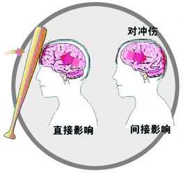器质性人格改变，揭秘大脑损伤背后的心理与行为变化