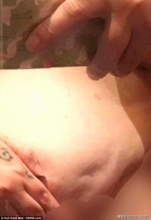 海城警报，辽宁发现疑似阳性病例，我们如何保持警惕？