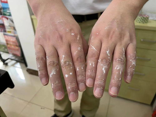 深入解析，为何突然暂停全员核酸检测及其背后的考量